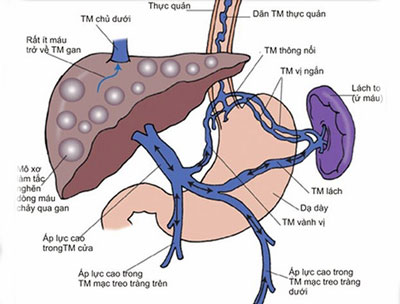 Lách to - Hình ảnh minh họa